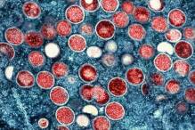 Studie: Ursprung des Mpox-Ausbruchs liegt länger zurück 
